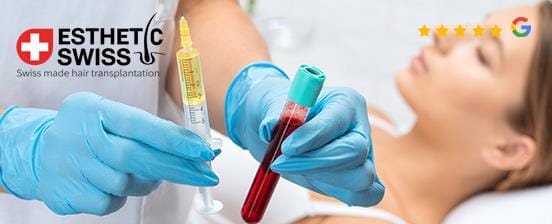 PRP – das Vampire Lifting für Gesicht oder Haare