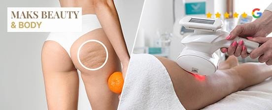 Anti-Cellulite-Kombi mit Lymphmassage und VelaShape