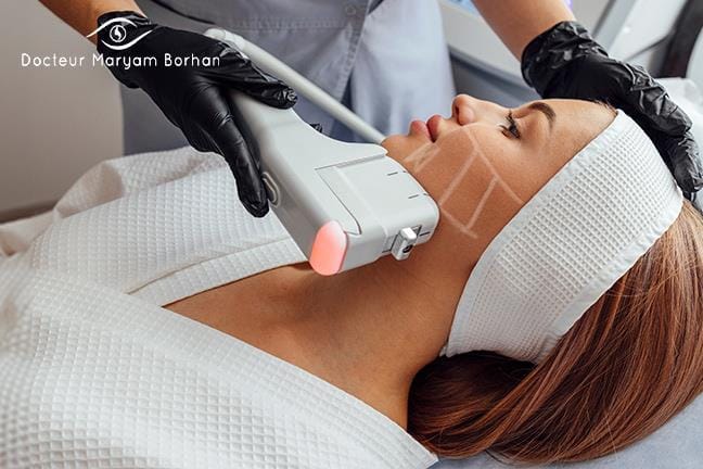 HIFU lifting visage ou cou