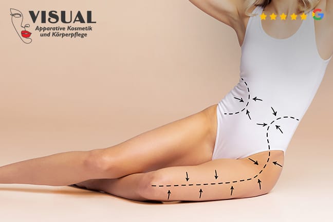 Kryolipolyse inkl. Lymphdrainage