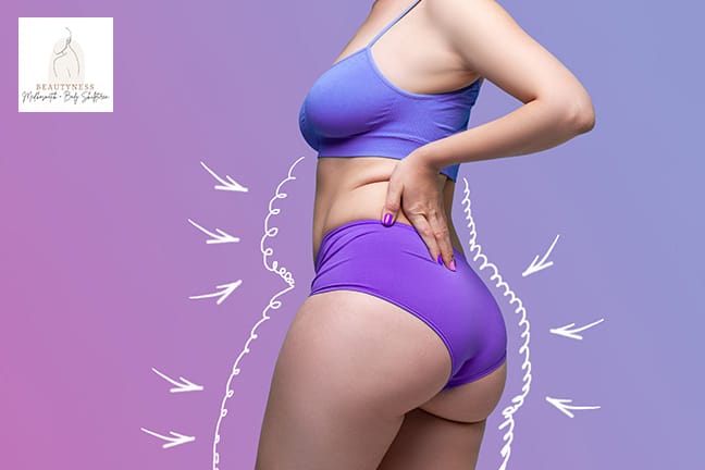 Proshock Ice gegen Fettpolster oder Cellulite