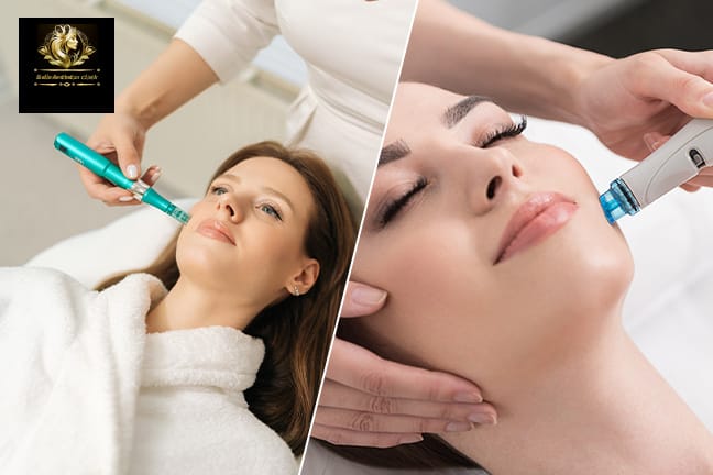 3-in-1: Microneedling, LED und HydraFacial