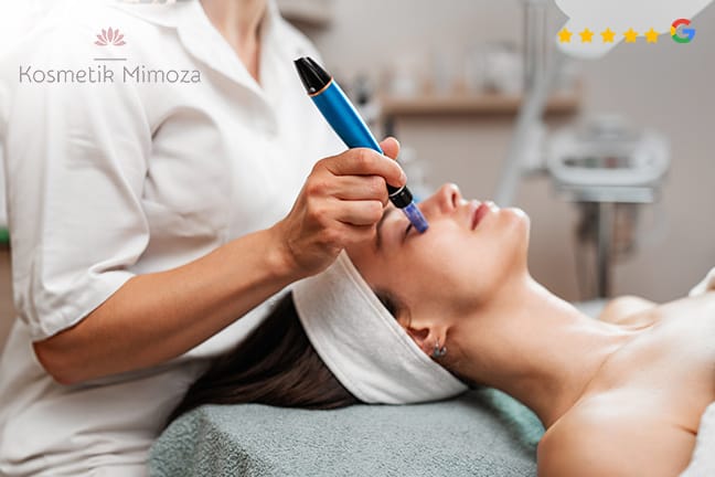 Dermaneed-Microneedling für Hautstraffung und Verjüngung