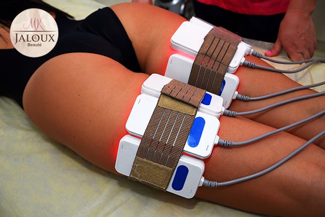 Cellulite- und Fettreduktion mit Lipolaser