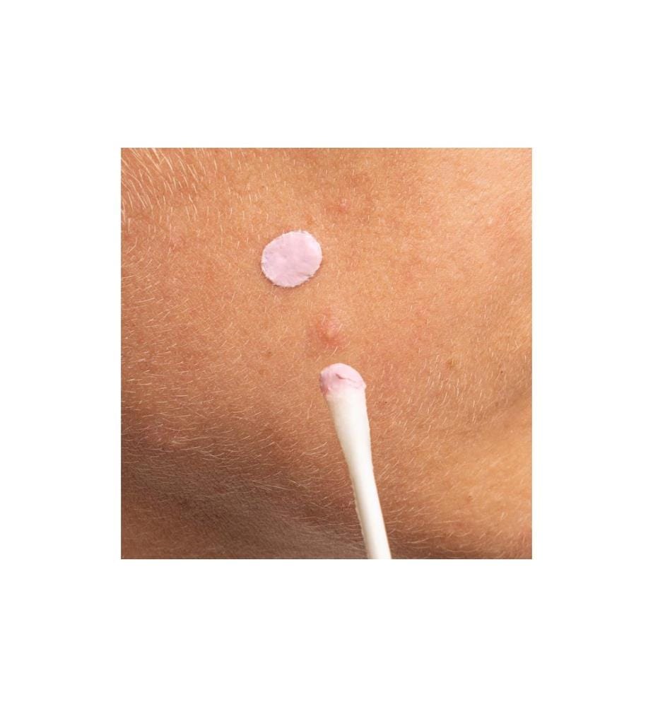 MIZON - Pink Spot Good Bye Blemish Overnight Spot Care 19 ml