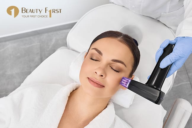 Radiofrequenz-Microneedling mit Hyaluron-Lifting