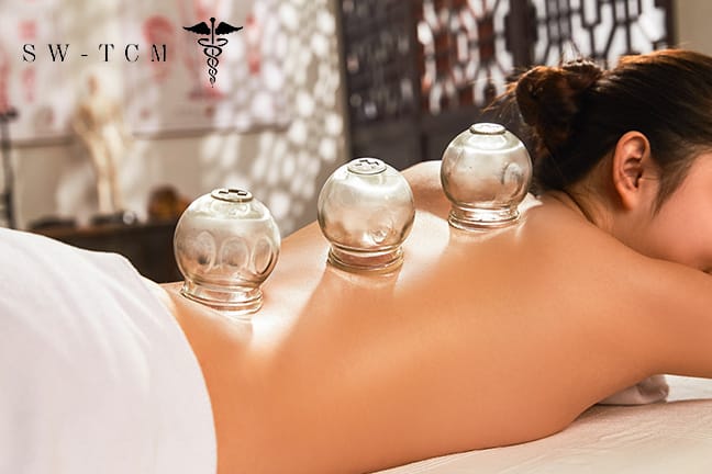 Akupunktur, Massage und Schröpfen nach TCM
