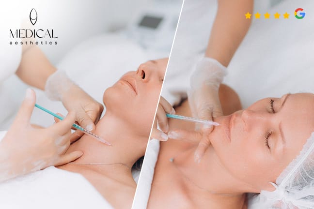 Mesotherapie zur Hautverjüngung im Kreis 1
