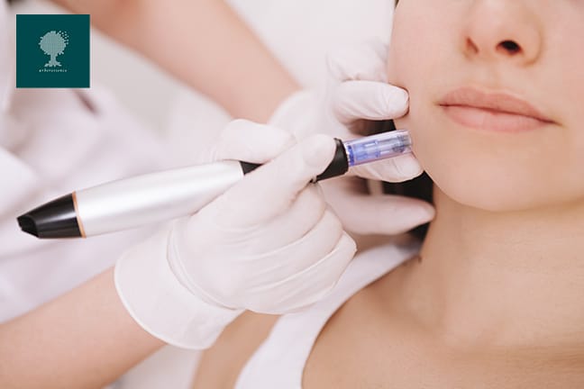 Soin anti-âge par microneedling