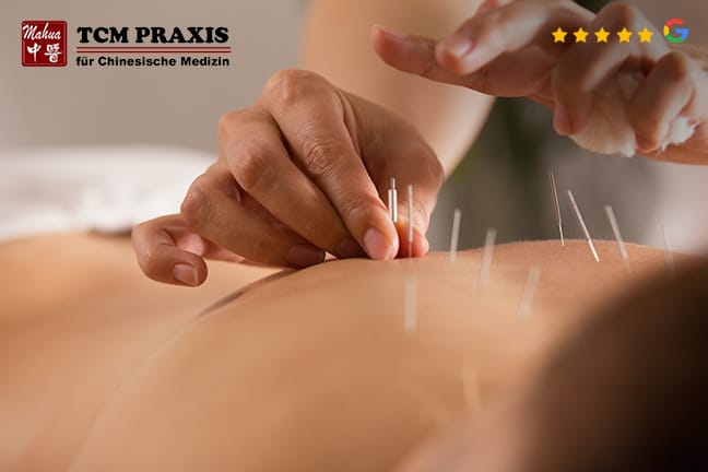 TCM-Behandlung – Traditionelle Chinesische Medizin