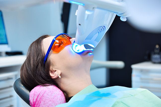 In-Office-Powerbleaching – optional mit Dentalhygiene