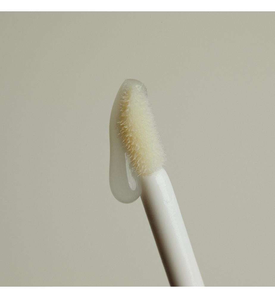 Lippenaufpolsterung mit Hyaluronsäure - 8.5 ml
