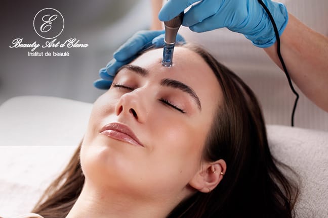Microneedling - visage / cou