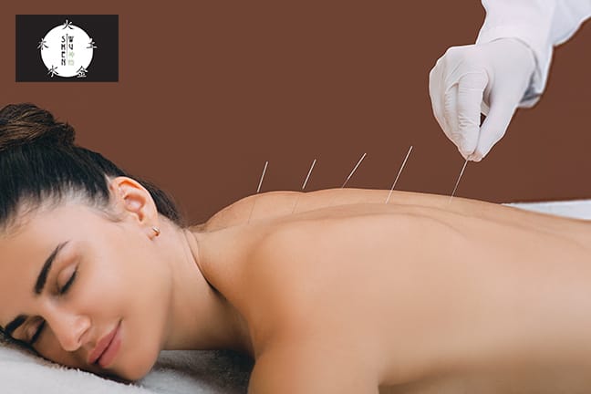 TCM-Behandlung (Traditionelle Chinesische Medizin)