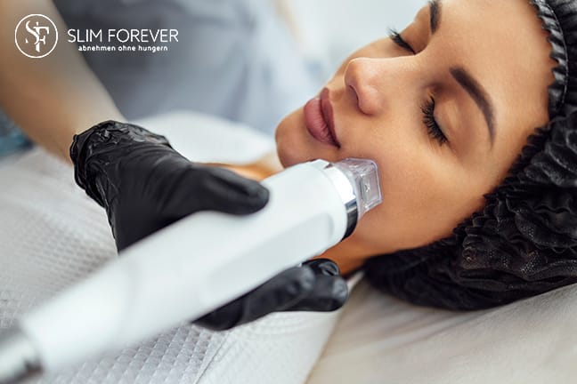 Radiofrequenz mit Microneedling