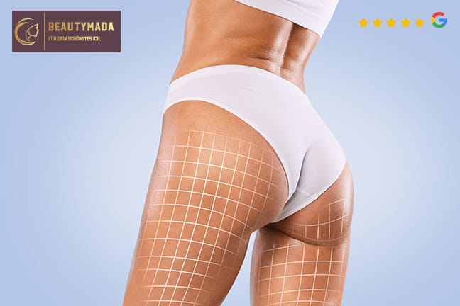 Anti-Cellulite-Behandlung