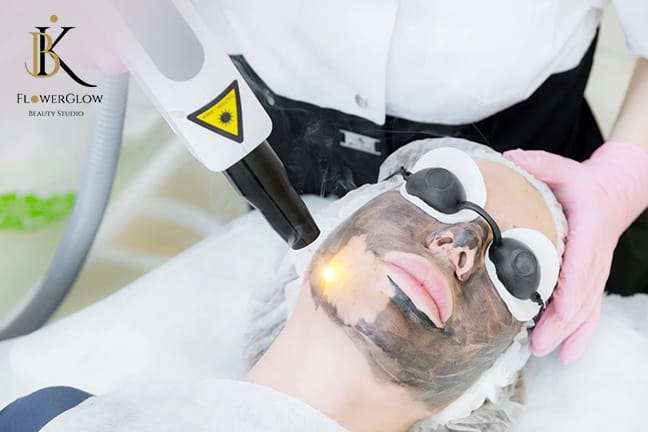 Carbon Peeling – das Hollywood Peel