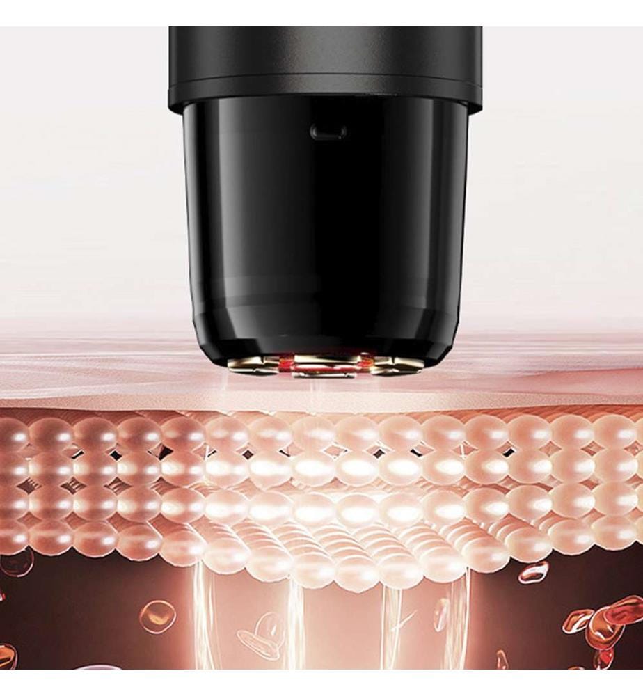 Multifunktionales Gesichtsmassagegerät mit Radiofrequenz, Mikrostrom und Lichttherapie – Schwarz
