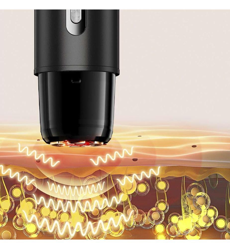 Multifunktionales Gesichtsmassagegerät mit Radiofrequenz, Mikrostrom und Lichttherapie – Schwarz
