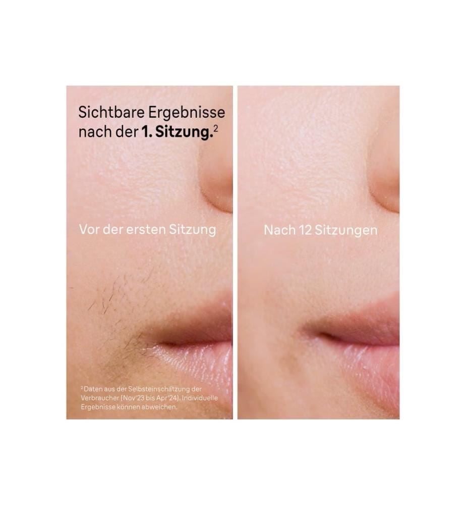 Épilateur Braun Smart IPL Skin i·expert – PL7249