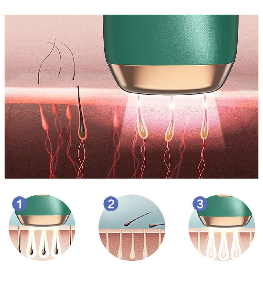 T4 IPL épilateur à lumière pulsée 5 degrés d'intensité, lumière continue de haute intensité 999 999 impulsions - Vert foncé