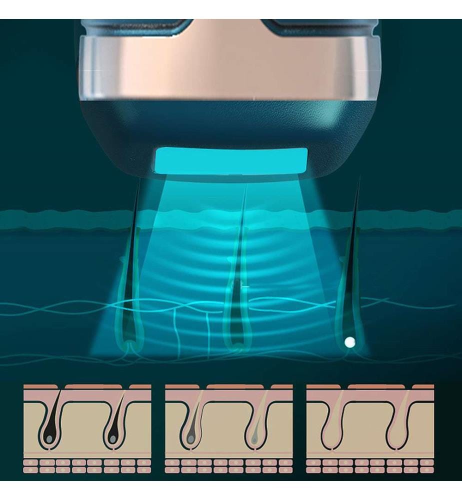 Épilateur à lumière pulsée T58 IPL avec base de chargementRefroidissement enveloppant à 360 degrésGrande et petite têtes remplaçables, épilation plus préciseBase de désinfection avec lampe UV - Vert foncé