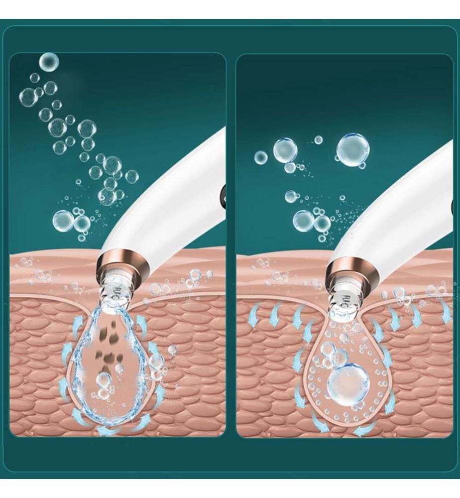 X13 Estrattore di punti neri con piccole bolle, circolazione dell'acqua3 MODI per tutti i tipi di pelle - Bianco