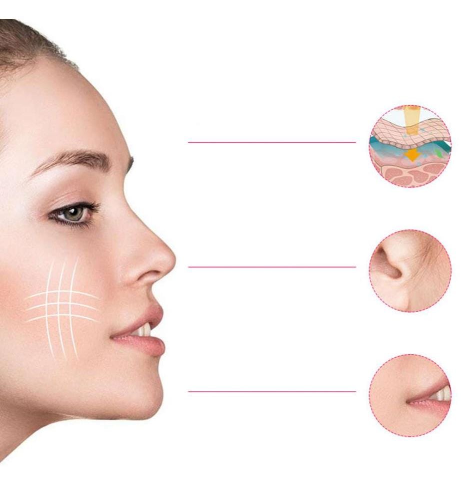 Appareil d'électrostimulation faciale EMS. Raffermit, remodèle et lisse les signes de l'âge - Blanc