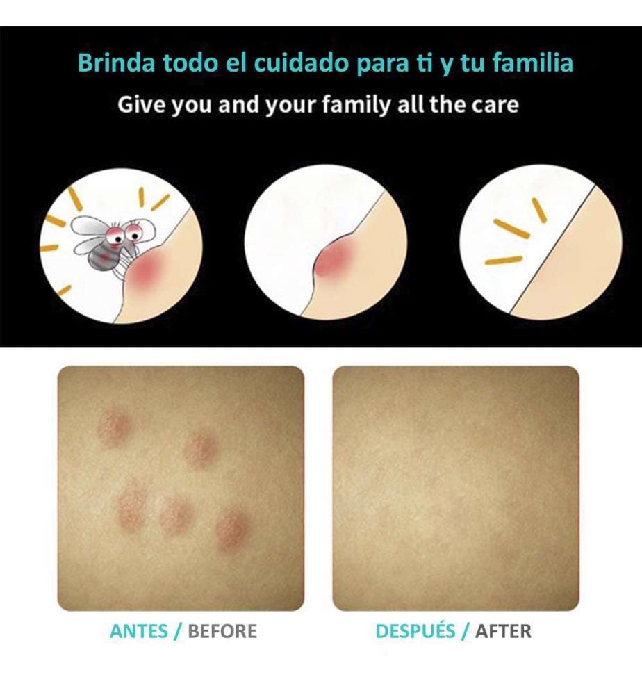 Relieves insect bites. Chemical-free treatment - White