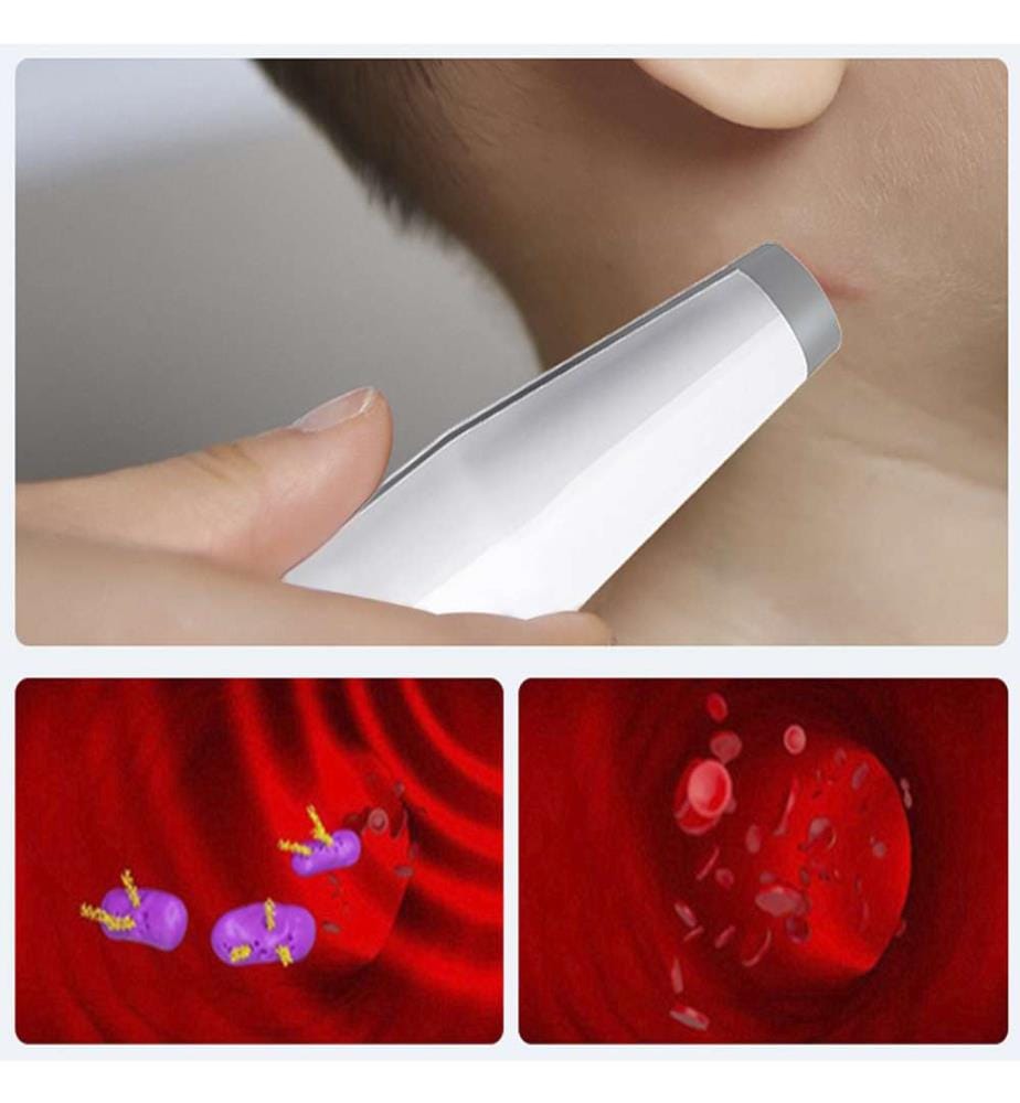 Soulagement des piqûres d'insectes. Appareil électronique pour soulager les piqûres de moustiques et de punaises de lit - Blanc