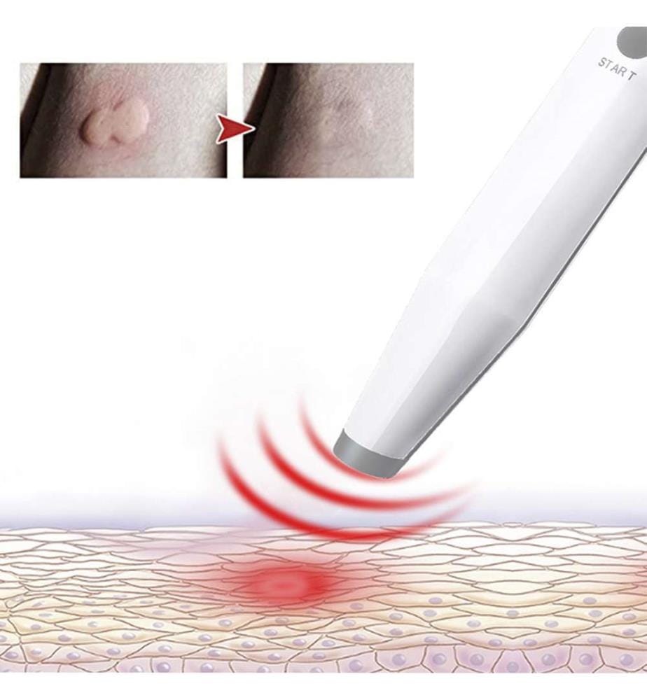 Soulagement des piqûres d'insectes. Appareil électronique pour soulager les piqûres de moustiques et de punaises de lit - Blanc