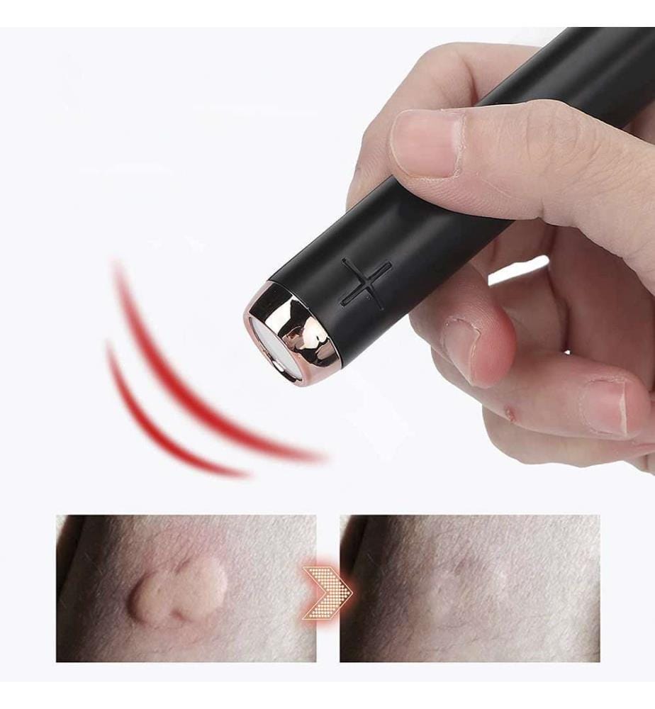 Electronic anti-insect bite device. Anti-insect-bite pen with chemical-free treatment - Black