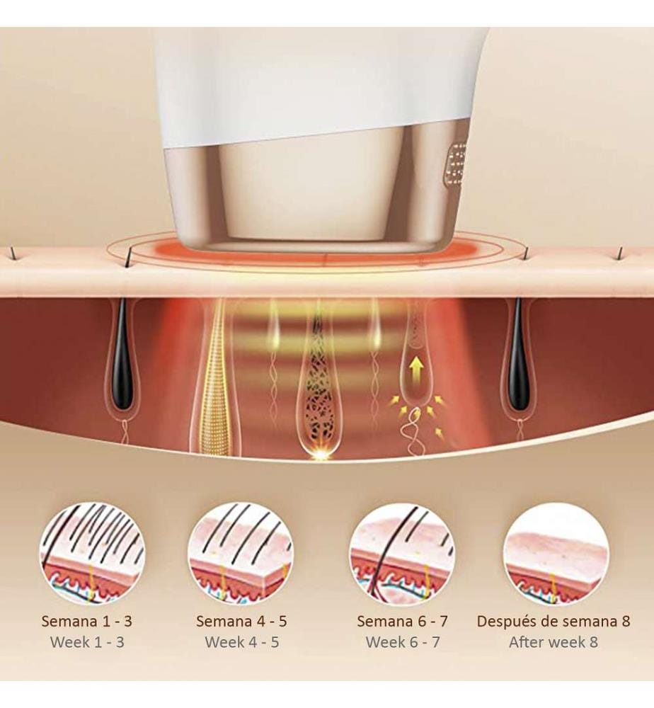 Épilateur à lumière pulsée Ts8 - Blanc