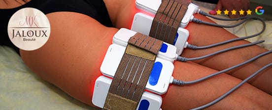 Cellulitebehandlung und Fettreduktion mit Lipolaser