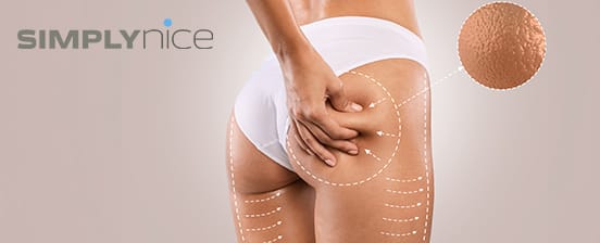 Cellulite-Powerbehandlung