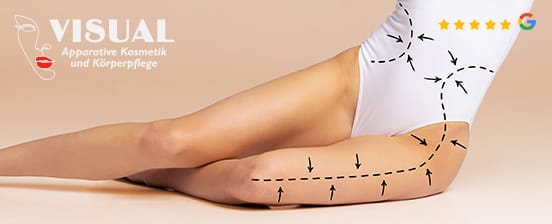 Kryolipolyse inkl. Lymphdrainage