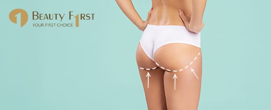 Po-Straffung mit Kollagen-Mesotherapie