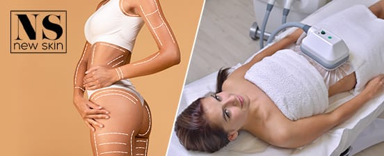 Kryolipolyse inkl. Lymphdrainage
