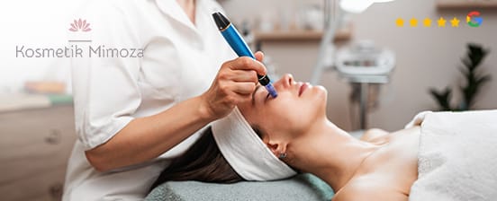 Dermaneed-Microneedling für Hautstraffung und Verjüngung