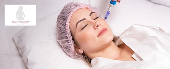 Medical Microneedling – Kollagenbooster für die Haut