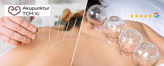 Akupunktur, Massage und Schröpfen nach TCM