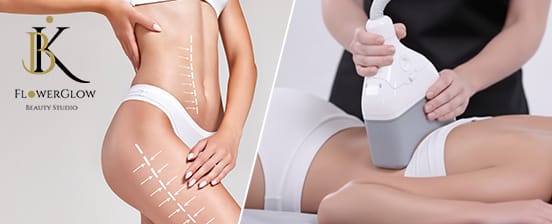Neuheit: 360°-Kryolipolyse, Lymphdrainage und Radiofrequenz