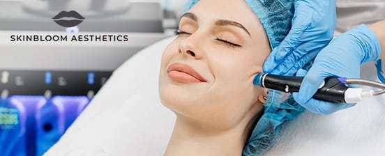 HydraFacial – der Frischekick für deine Haut