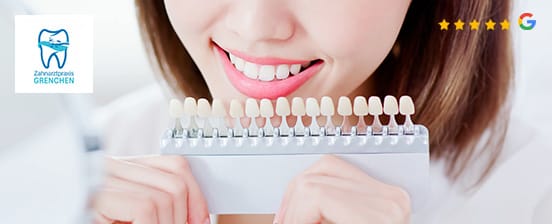 Powerbleaching – optional mit Kontrolle und Dentalhygiene
