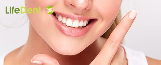 Zahnreinigung oder Bleaching