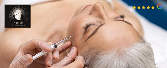 Radiesse® Filler für Volumen und Straffung