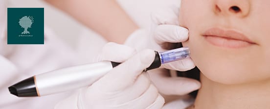 Soin anti-âge par microneedling