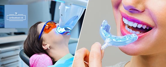 In-Office-Powerbleaching – optional mit Dentalhygiene