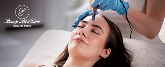 Microneedling - visage / cou