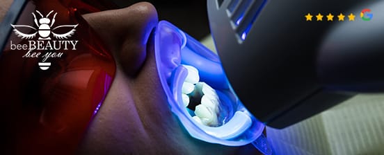 Kosmetisches Zahnbleaching